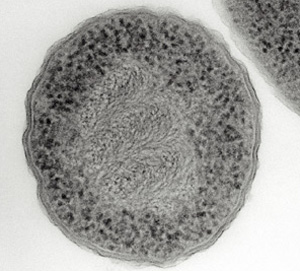 prokaryote (Escherichia coli)